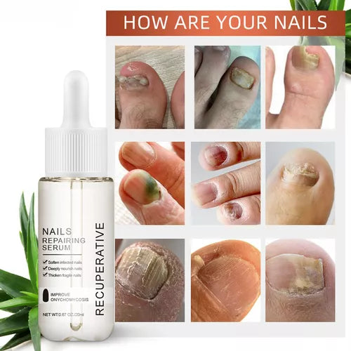 Uñas Sanas y fuertes en 7 Dias ⭐️⭐️⭐️