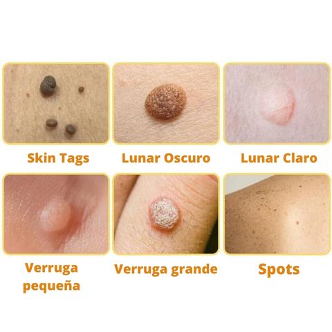 DermaBEE con veneno de abeja