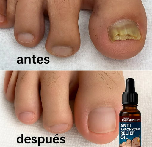 ANTIHONGOS PIES Y MANOS LLEVA 2 X Q190 SUPER OFERTA